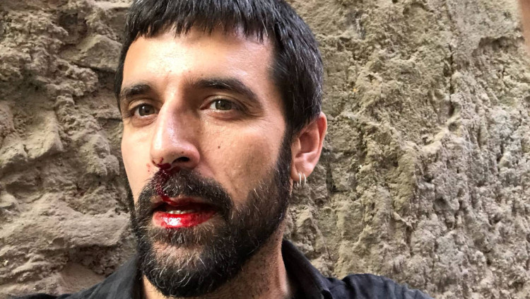 El fotoperiodista Jordi Borràs, després de l'agressió