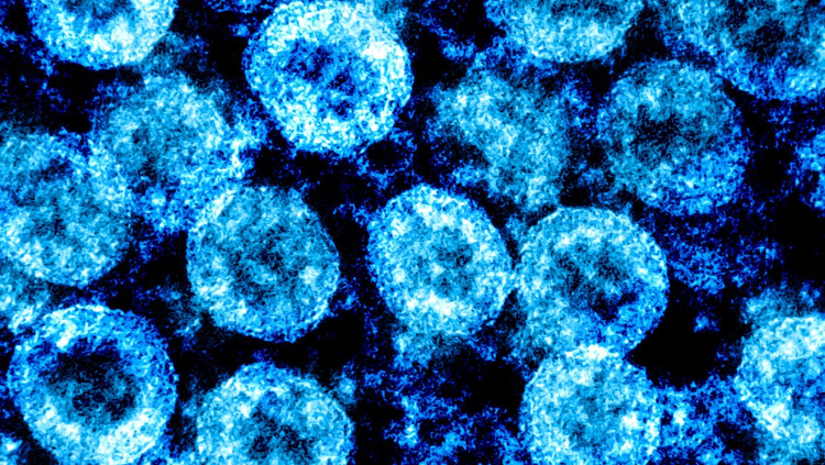 Imatge del SARS-CoV-2 obtinguda per microscopi electrònic a la Integrated Research Facility del National Institute of Allergy and Infectious Diseases, a Fort Detrick, Maryland, EEUU (2020)