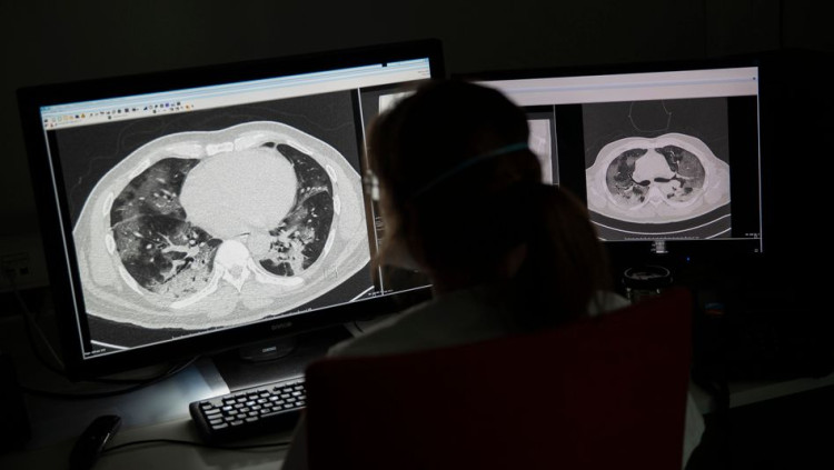 Un metge observa els pulmons d'un pacient contagiat per coronavirus. Der Spiegel